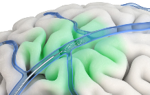 意念操控设备新突破 脑机接口技术改变交互方式(图3)