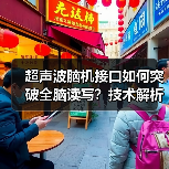 超声波脑机接口如何突破全脑读写？技术解析与未来展望（图4）
